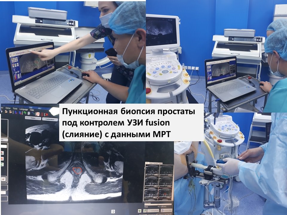 В КазНИИОиР прошел семинар по внедрению новой технологии биопсии простаты в Казахстане
