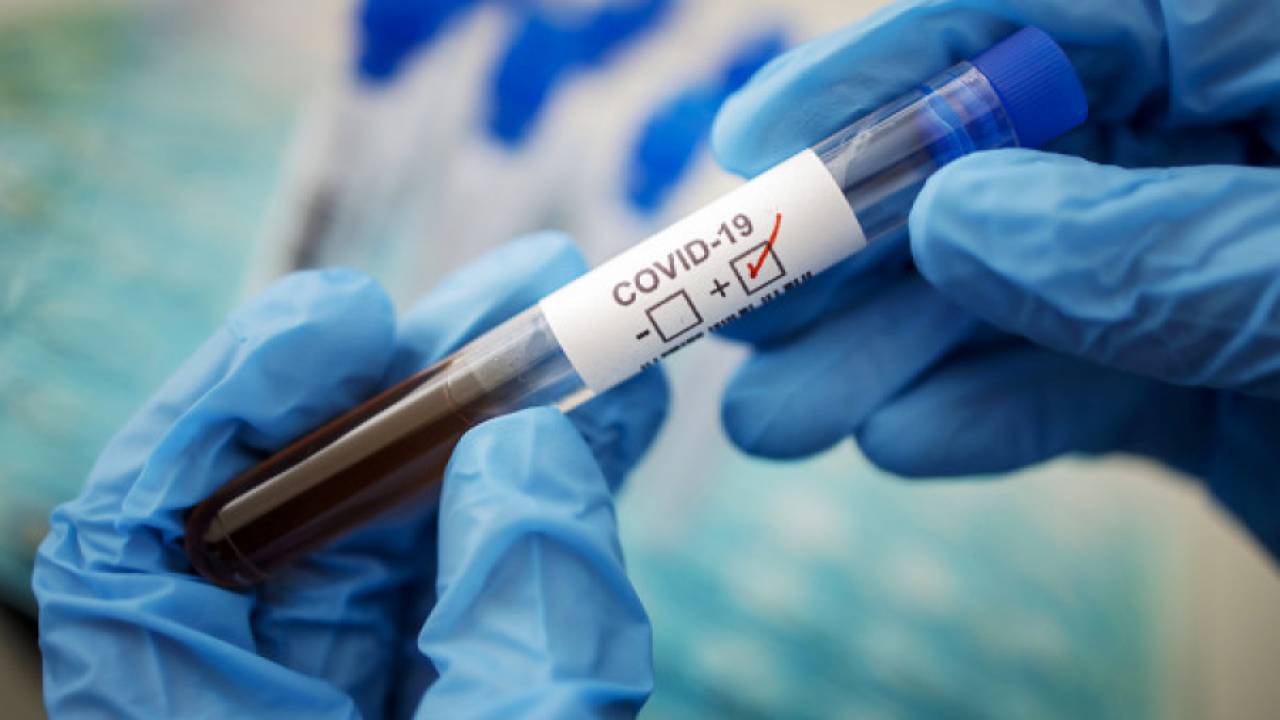 Рекомендации онкологов по вакцинации онкобольных от коронавируса в Казахстане